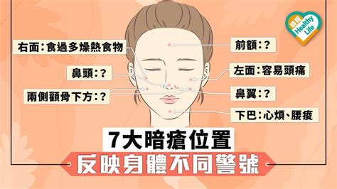 鼻頭生暗瘡意思|12個暗瘡位置揭示身體狀況｜中醫拆解人中、下巴、額 